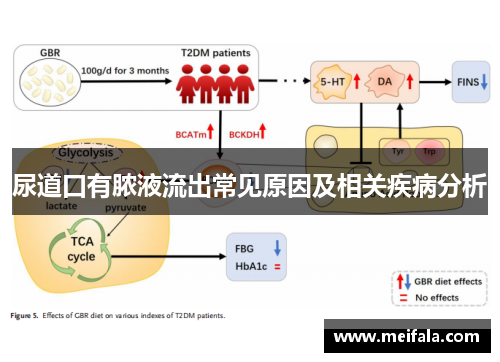 尿道口有脓液流出常见原因及相关疾病分析